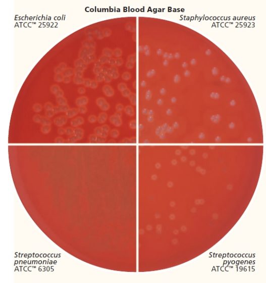 Sheep Columbia Blood Agar Plates (14x1) CA002 At Rs 700 In Delhi - ID: 2019781 - Foto 9