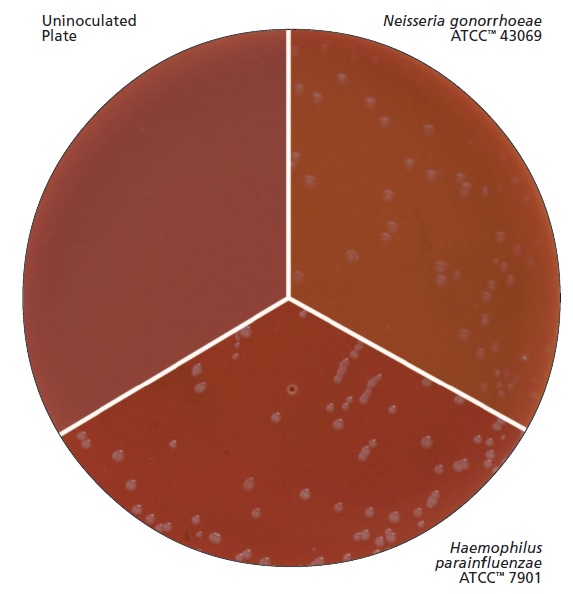 GC Medium Base (base para Agar Chocolate e Thayer Martin) Interlab